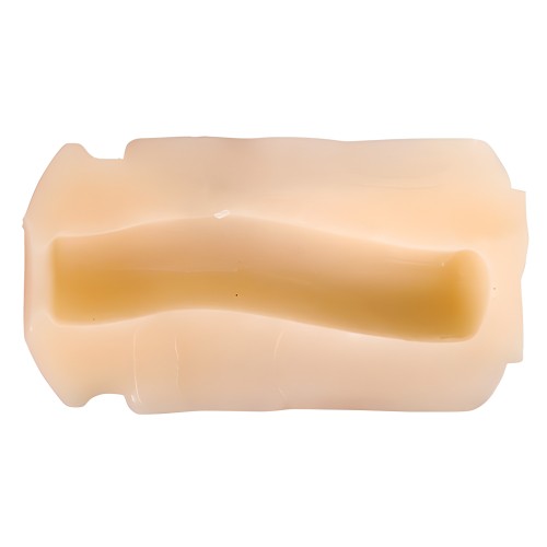 Rends Vorze A10 Cyclone Insert