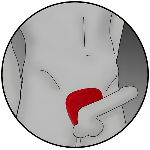 Anillo de Cock Bi-Polar ElectraStim Silicone Fusion